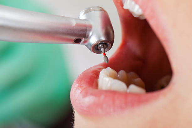 Best Broken Tooth Emergency  in Dove Valley, CO